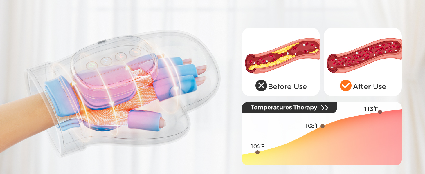 How Clariven works: warmth zones over the hand, before/after circulation, and three calibrated temperatures (104, 108, 113°F)